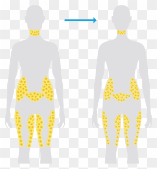Normal Weight Loss - Fat Cells Are Located Clipart