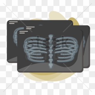 X-ray Of Human Rib Cage V矢量图形 - Thorax Clipart