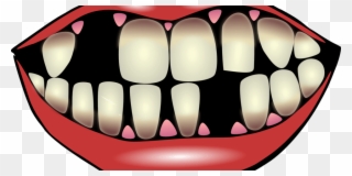 Missing Teeth Dentist - Perdida De Dientes Dibujo Clipart