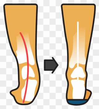 Podsoles Medical Orthotics & Footwear - Medicine Clipart