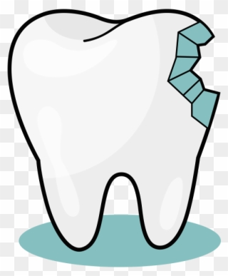 From Small Tender Baby Teeth, To The Wisdom Teeth Causing Clipart