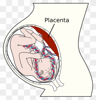 Placenta Anterior Upper Segment Grade 1 Maturity Clipart