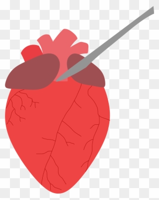 Place The Heart So The Anterior Side Is Facing Up - Illustration Clipart