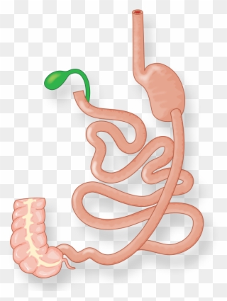 Illustration Of Intestines And Stomach After Duodenal - Duodenal Switch Clipart