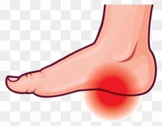 Feet Clipart Ankle - Foot Pain Clipart - Png Download
