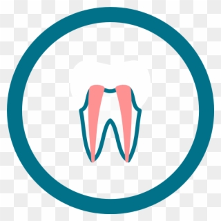 What Is Root Canal Treatment Clipart