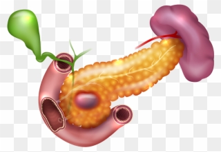 Darkspots In Pancreas - Spleen Liver Clipart