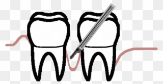 Periodontal Disease Is The Second Largest Cause Of - Periodontology Clipart