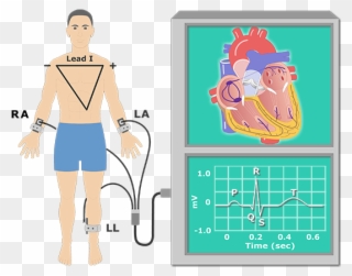 Ecg Cartoon Clipart Electrocardiography The Electrocardiogram - Png Download