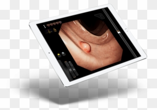 Experience Gastro Ex, The First Virtual Surgery Mobile Clipart