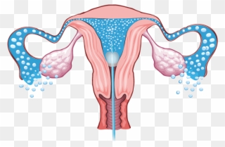 Cost-effective, Convenient, And Proven - Female Reproductive System Without Names Clipart