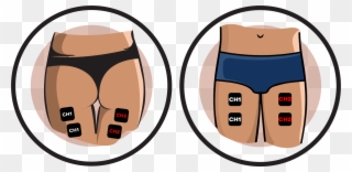 Thigh Electrode Pad Placement Clipart