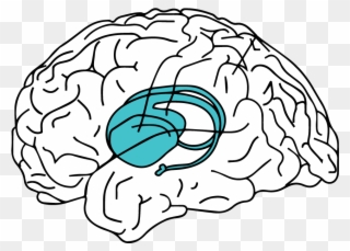 Sound Instantly Accesses The Hippocampus Where - Henry Gustav Molaison Star Clipart