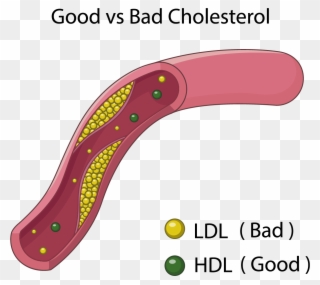 Goodvsbad Cholesterol - Good Bad Cholesterol Clipart