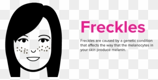 Freckles Png - Freckles Cartoon Clipart