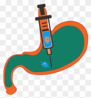 Gastric Botox Clipart