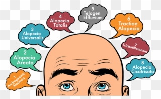 Types Of Hair Loss You Must Learn About - Bald Man Illustration Clipart