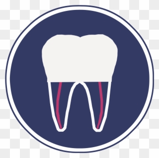 Ac Root Canal Treatment Clipart