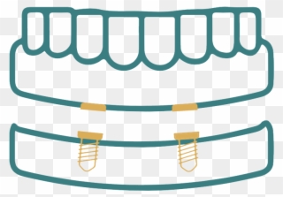 Full Mouth Rehabilitation Png Clipart