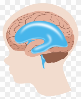 Hydrocephalus Is Most Often Treated By Surgically Inserting - Hydrocephalus Transparent Clipart