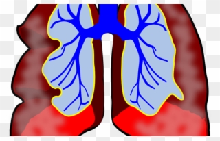 Fighting Fungous Respiratory Organ Infections With - Lungs Clip Art - Png Download