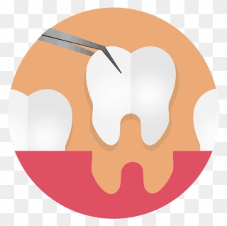 Three Teeth With One Being Extracted Graphic - Illustration Clipart