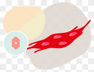 Why Store Umbilical Cord Tissue Cells - Injury Clipart