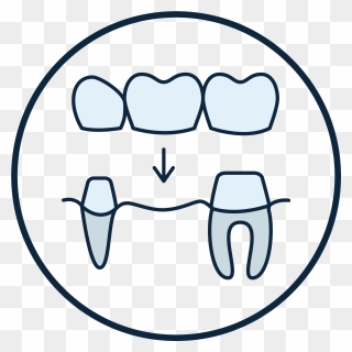 Icon For Dental Bridge Clipart