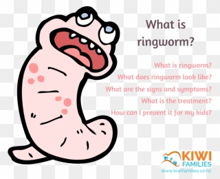 Worms Clipart Ringworm - Ringworm Nz - Png Download
