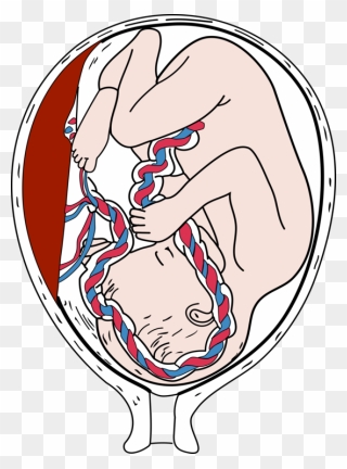 Emotion,art,human - Placenta Png Clipart