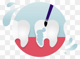 Applying Topical Fluoride To Protect Tooth Enamel - Graphic Design Clipart