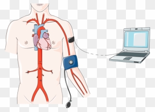Cardiac Catheterization Clipart