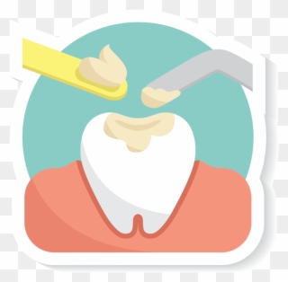 Dental Fillings - Illustration Clipart