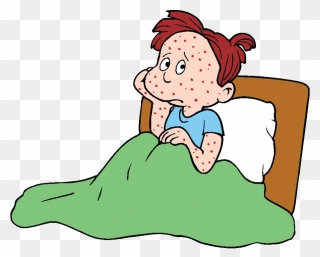 How To Deal With - Chicken Pox Clipart - Png Download