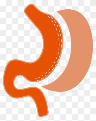 Laparoscopic Sleeve Gastrectomy Logo Clipart