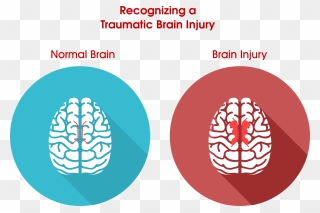 Tell If You Have Brain Damage Clipart