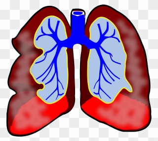 What Is Bronchitis Omaha Urgent Care - Lungs Clip Art - Png Download