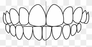 Crooked Teeth - Brasilia Tv Tower Clipart