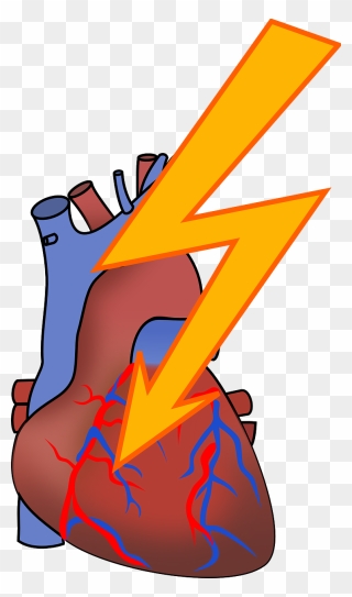 Heart Attack Png Images - Clip Art Heart Attack Transparent Png