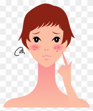 Woman Girl Skin Diseases Clipart - Acne - Png Download