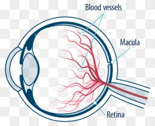 Eye Blood Vessels, Macula, And Retina - Macular Degeneration Eye Png Clipart Transparent Png