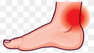 Achilles Tendonitis - Foot Pain Clipart - Png Download