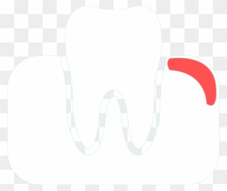 Known To Lead To Gum Problems , But There Are Also - Gums Clipart
