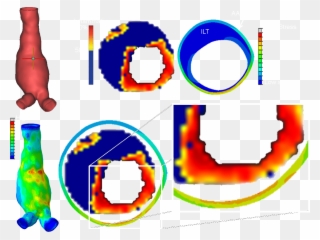 And Strains In The Vascular Tissue, Whereas With Computational - Circle Clipart
